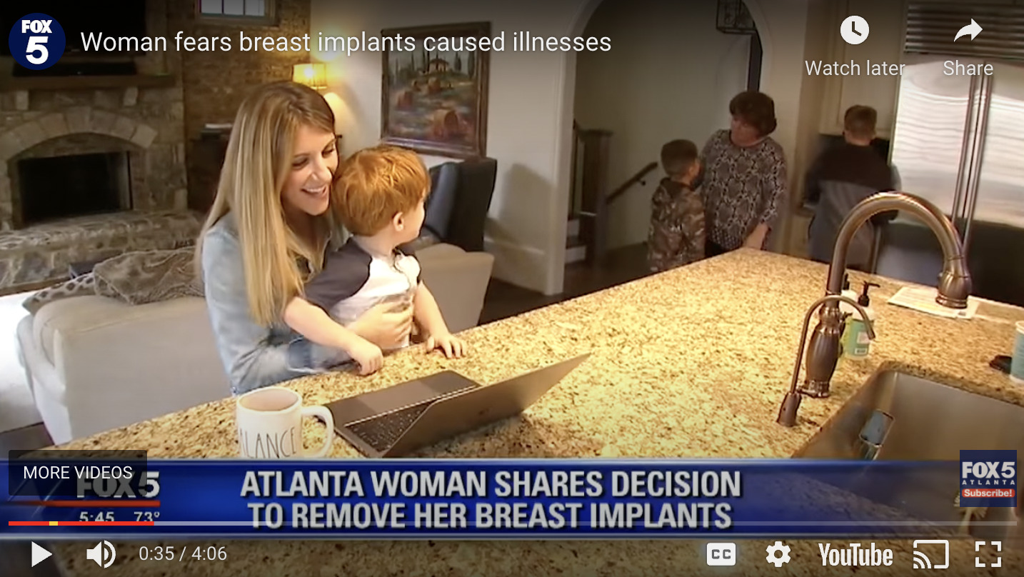 Breast Implant Removal (Explant) in Midtown Atlanta and Alpharetta