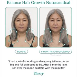 Female Nutrafol Women's Balance before and after