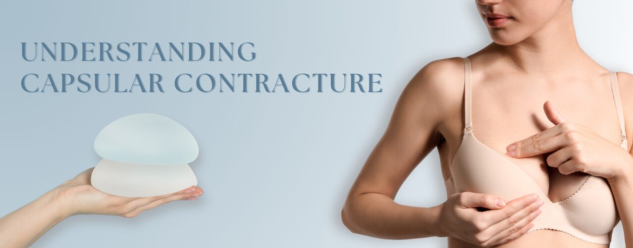 Woman holding breast and another hand holding implants with the words Understanding Capsular Contracture on the banner