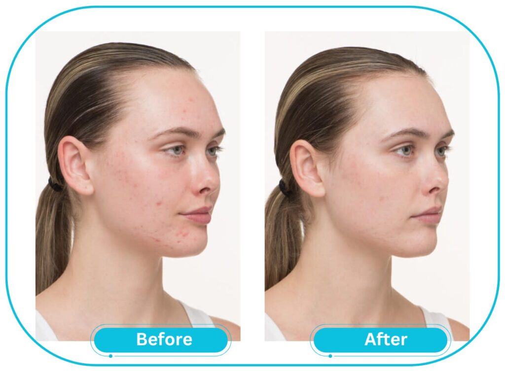 Nutrafol Skin female before and after