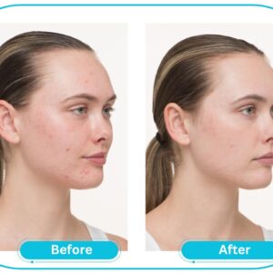 Nutrafol Skin for Women before and after